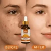 Relax comparison Relax Vitamin C Daily Serum 30ml – Brightening, Hydrating & Skin Tightening Face Serum for Glowing Skin