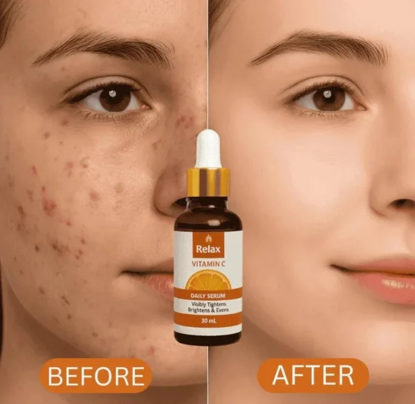Relax comparison Relax Vitamin C Daily Serum 30ml – Brightening, Hydrating & Skin Tightening Face Serum for Glowing Skin